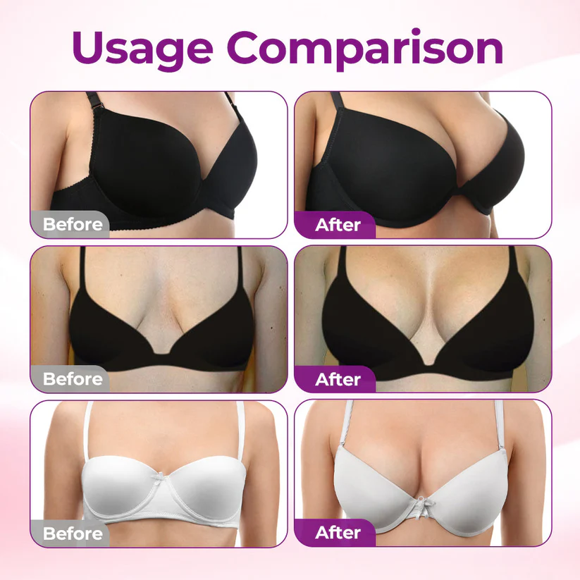 Alcuras® Targeted Breast Enhancement Advanced Nano Microneedle Patch