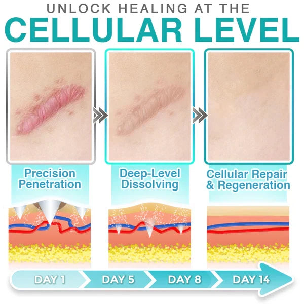 CareBrezza® 3-in-1 Scar Removal Microneedle Care Patch 💡