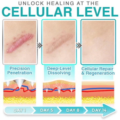 CareBrezza® 3-in-1 Scar Removal Microneedle Care Patch 💡