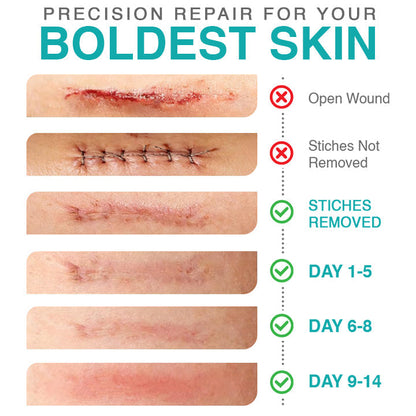 CareBrezza® 3-in-1 Scar Removal Microneedle Care Patch 💡