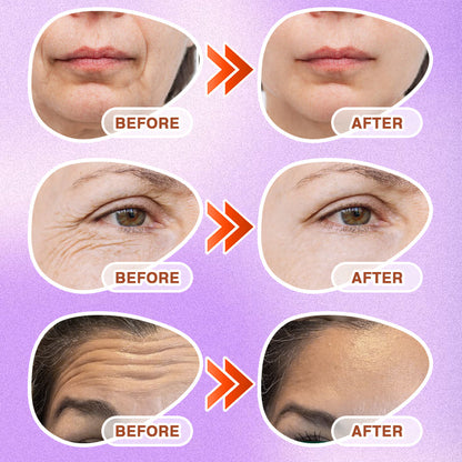 CareBreeza® 3-in-1 Microneedle Anti-Aging Patch